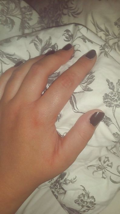 my sweedish friend's hand with nail