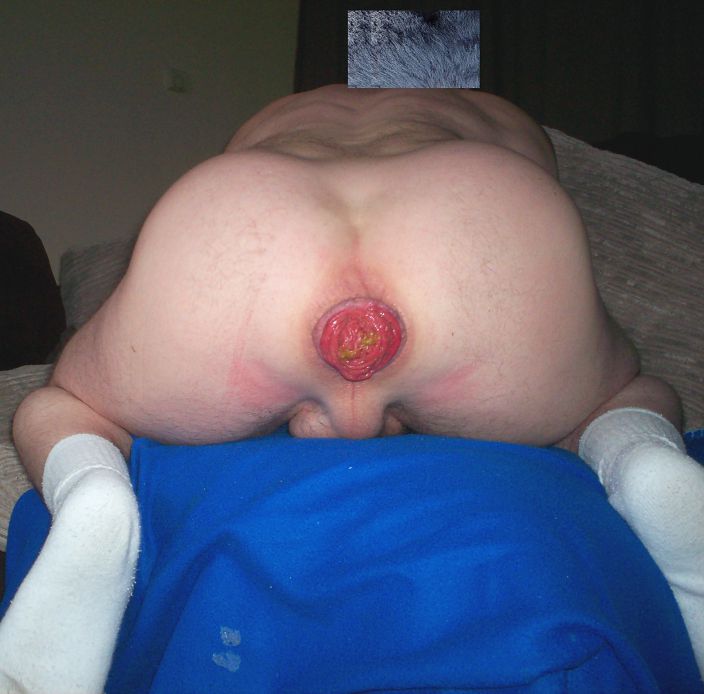 bum ass butt man hole rosebud pic