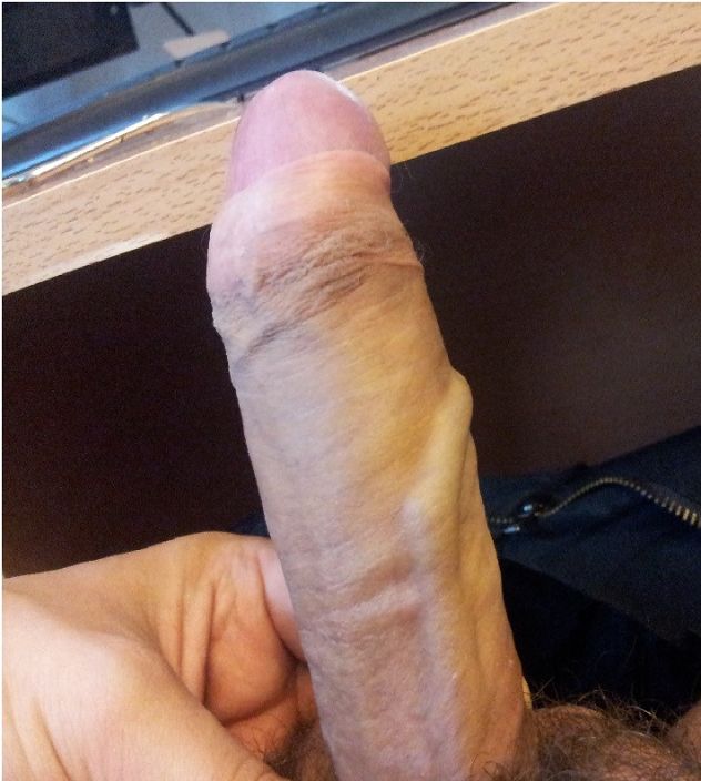Член